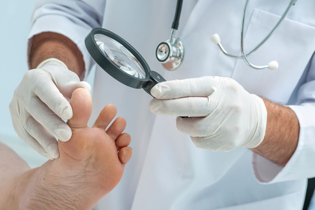 The spread of cork diseases