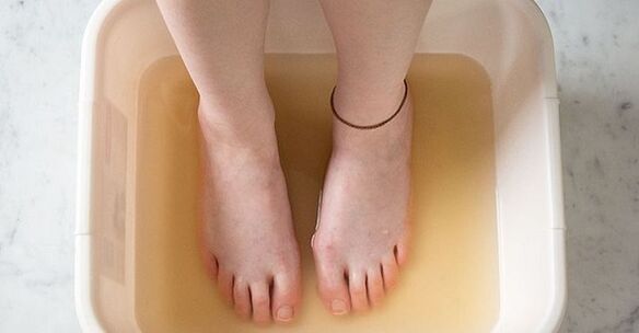 Iodine bath to treat nail fungus